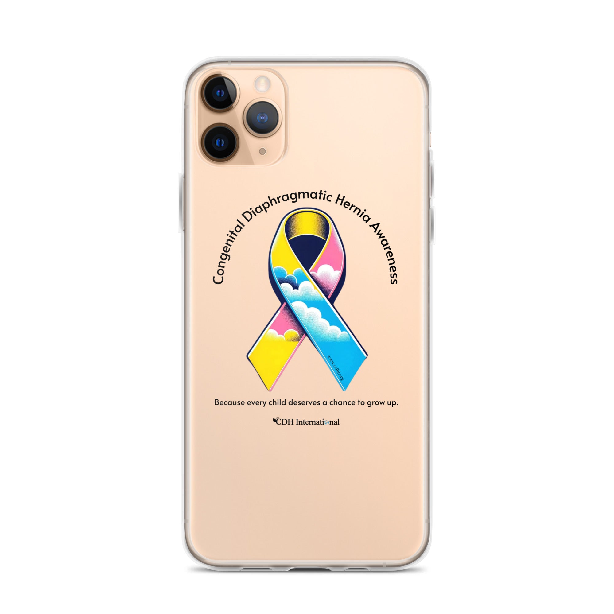 CDHAR- (47) Congenital Diaphragmatic Hernia Awareness Ribbon Clear Case for iPhone®