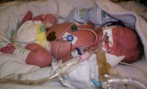 Donate now to Fight Congenital Diaphragmatic Hernia and help save children like Jeremiah.