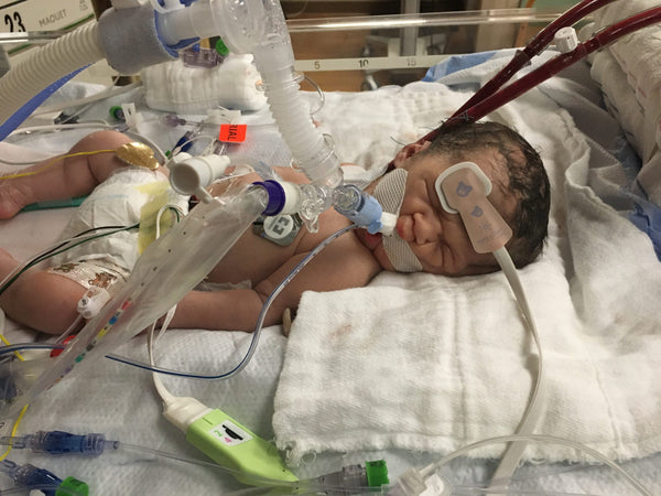 Donate now to Fight Congenital Diaphragmatic Hernia and help kids like Braden
