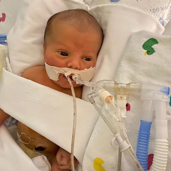 Donate now to Fight Congenital Diaphragmatic Hernia and help save babies like Kage.