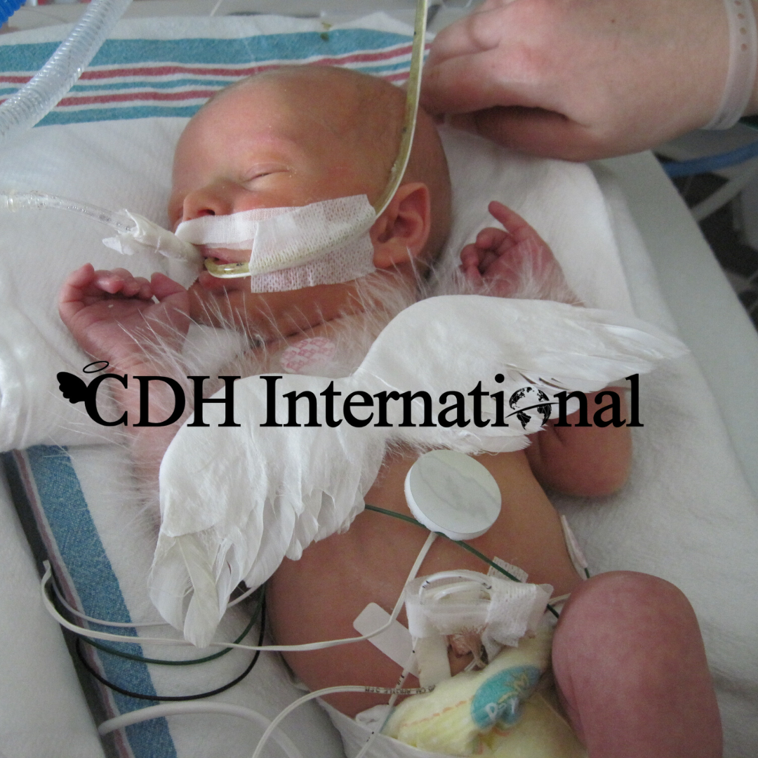 Donate now to Fight Congenital Diaphragmatic Hernia and help kids like Ben